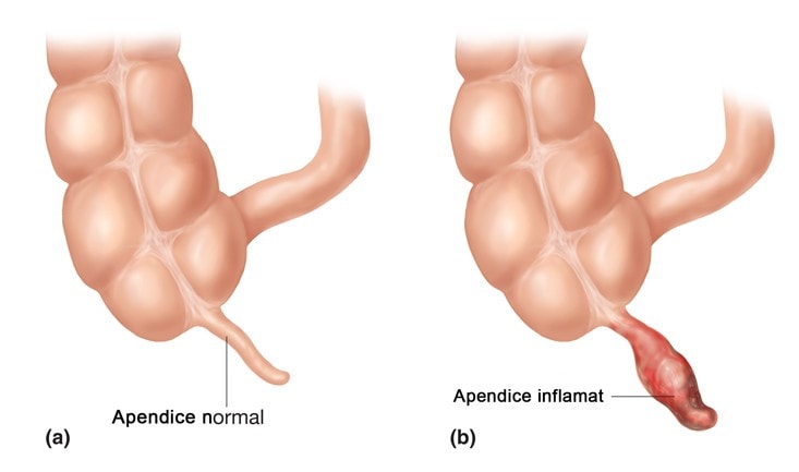 appendix.jpg