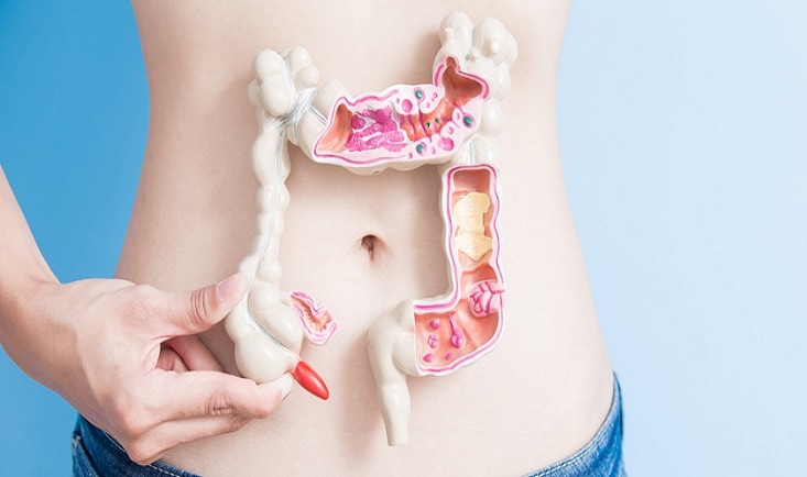Cum se tratează endometrioza uterină cu varice